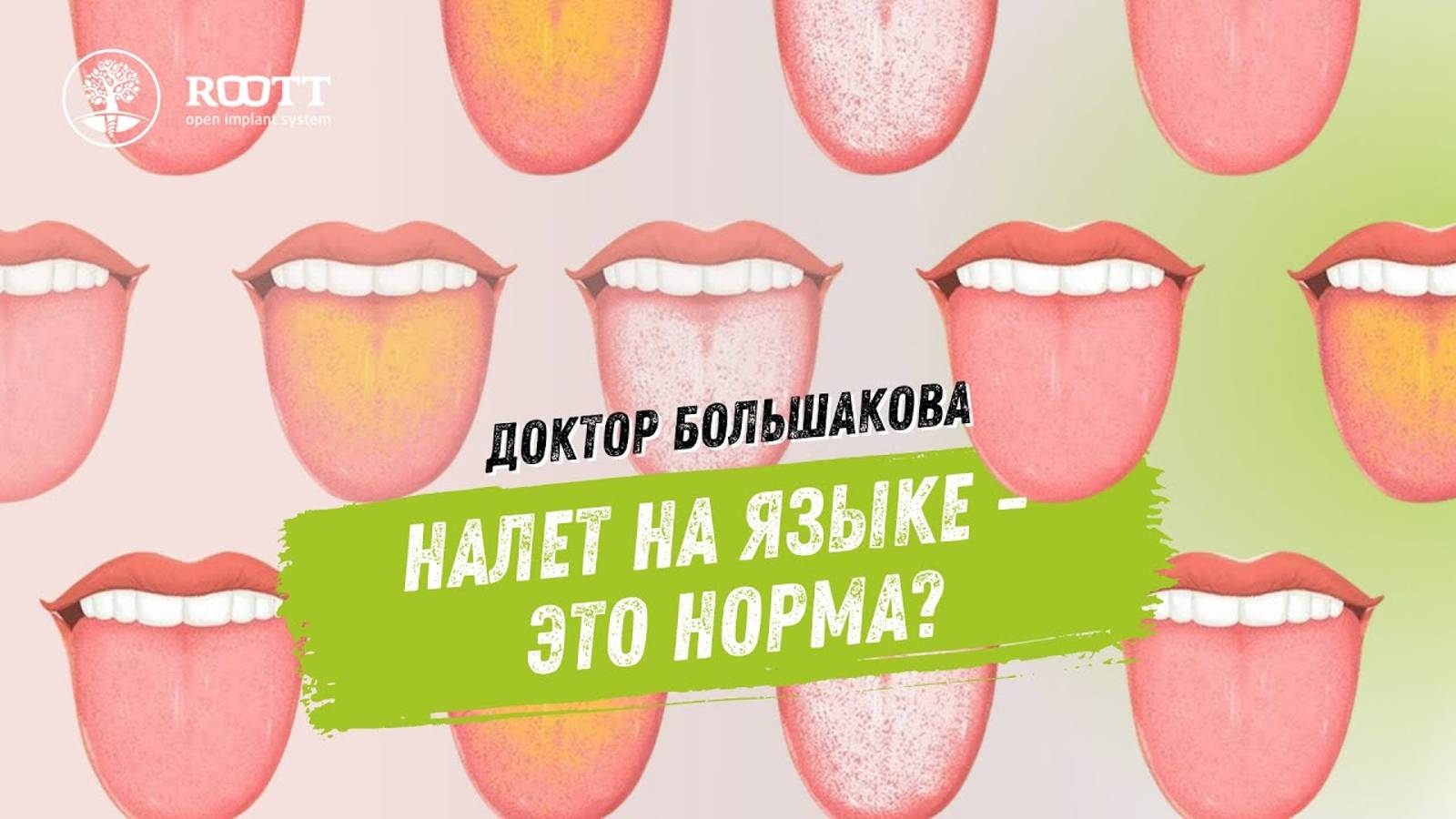 НАЛЕТ НА ЯЗЫКЕ что с ним делать и почему он появляется Рассказывает стоматолог-гигиенист ROOTT смотреть онлайн