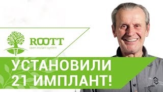 • Установка 21 импланта за 4 дня, отзыв пациента о процедуре имплантации и протезирования в ROOTT смотреть онлайн