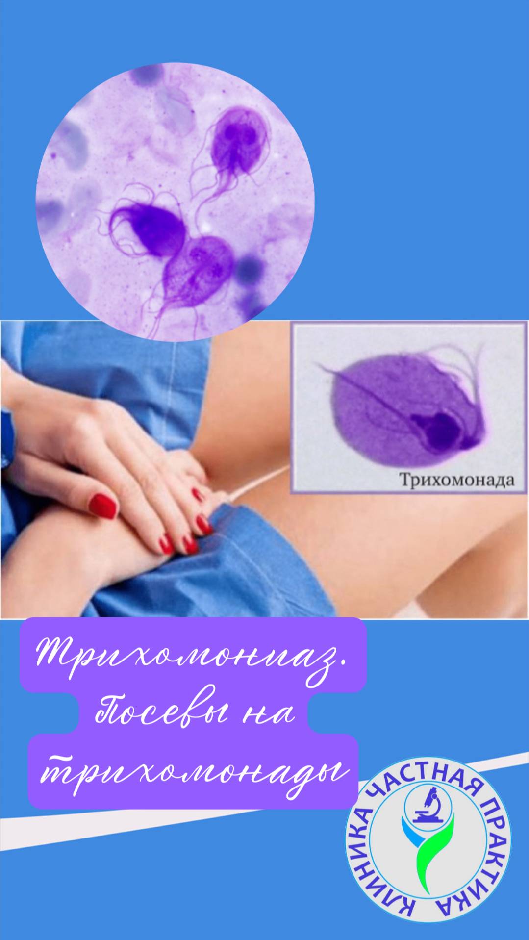 Посевы на трихомонады смотреть онлайн