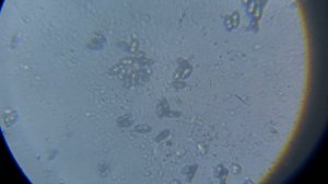 Грибы под микроскопом, обзор спор разных грибов!