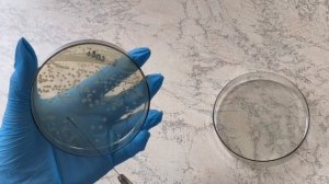 Техника посева микроорганизмов на скошенный агар с це