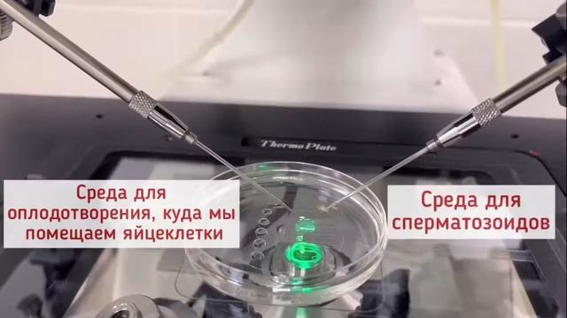 Откуда берутся дети? Аисты Гармонии показывают эмбрио смотреть онлайн