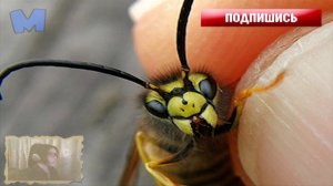 Что делать если укусила оса