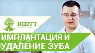 Установка импланта и удаление зуба за 1 визит. Установка импланта после удаления зуба смотреть онлайн