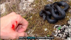 Укус ЗМЕИ.Чей яд опасный? Виды ядовитых змей!Первая по?