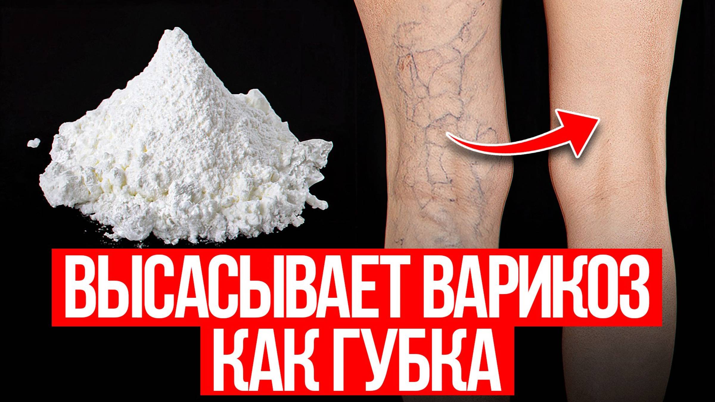 Оказывается, варикоз реально лечится! Простые средства есть у каждого дома! смотреть онлайн