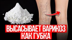 Оказывается, варикоз реально лечится! Простые средства есть у каждого дома!