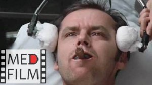 Ю.Г.Тюльпин про электросудорожную терапию (ЭСТ, электрошок) ©