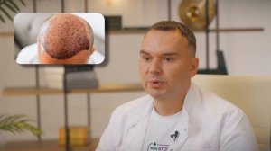 Пересадка волос. Какой метод выбрать: FUE или DHI | Алекса?