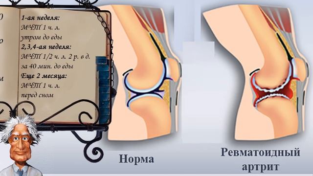 Масло черного тмина при лечении болезней легких, суст? смотреть онлайн