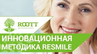 Полное восстановление зубов за 3 дня. Методика ReSmile на имплантах ROOTT. смотреть онлайн