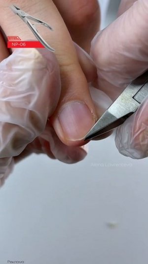 Вырос гипонихий