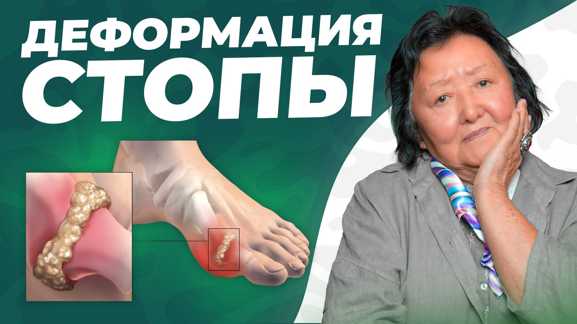 Скрытые причины болезней стопы