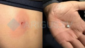 «До сих пор в шоке»: родители пострадавшей от пули девочки в Улан-Удэ рассказали подробности ЧП