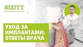 Уход за несъемными зубными протезами зубов. Как ухаживать за имплантами зубов? смотреть онлайн