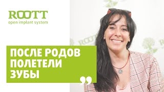 Отзыв С. Якоб по установке имплантов в клинике имплантации зубов ROОТТ в Москве смотреть онлайн