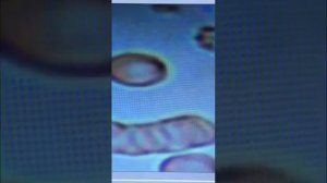 Результат крови до Массажа ПРИБОРОМ Magik и после