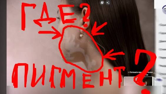 Витциферол. Волшебный крем от витилиго КАК вас обманывают