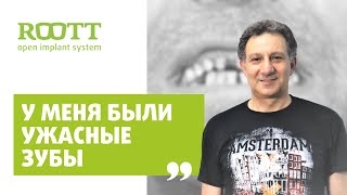 Отзыв М. Авадяева по установке имплантов в клинике имплантации зубов ROOTT в Москве смотреть онлайн