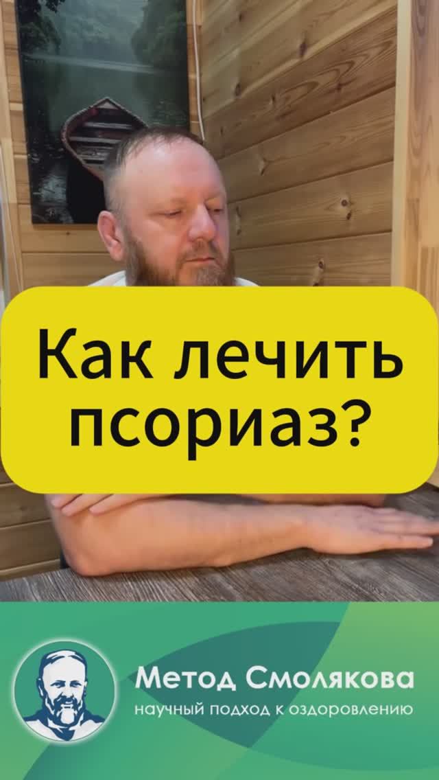 Как лечить псориаз смотреть онлайн