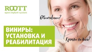 Установка виниров для зубов. Ответы на вопросы по зубным винирам. Часть 2 смотреть онлайн