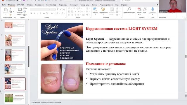 Врастают ногти. Больно ходить. Как помочь