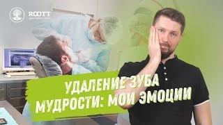 Удаление зуба мудрости у пациента Алексея А. Что делать если болит зуб мудрости? смотреть онлайн