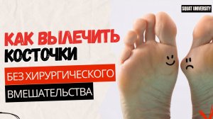 Как вылечить косточки на больших пальцах ног без хирургичестго вмешательства