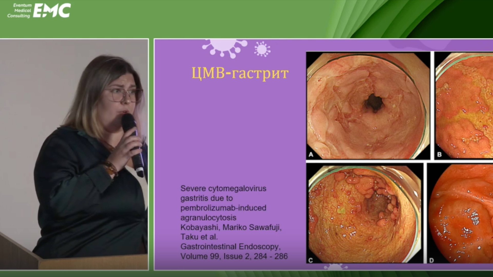 5. Дегтярева М.Ю. Вирусное поражение ЖКТ: найти и обезвредить. Как заподозрить и верифицировать?