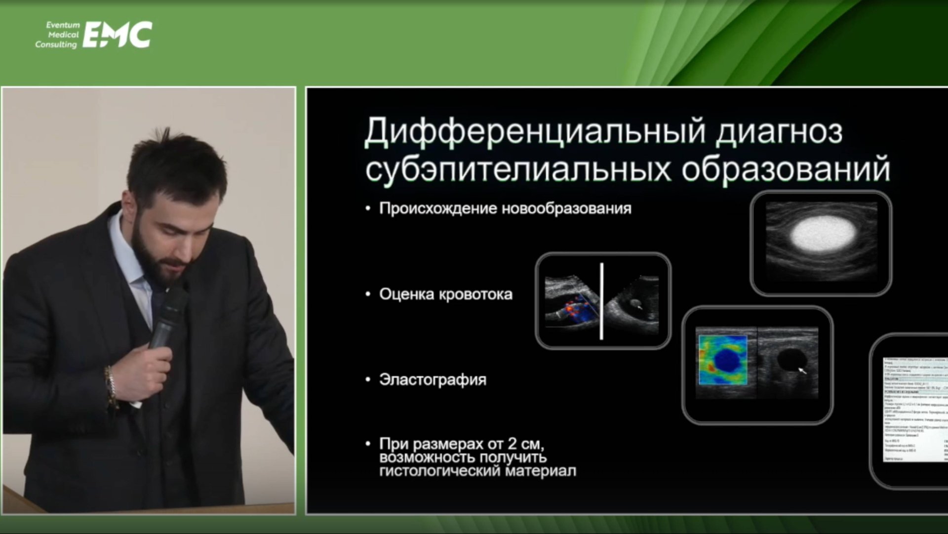 1. Омаров М.А. ЭУС в практике врача-эндоскописта онкологического стационара.