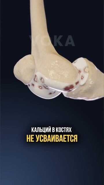 Пишите слово «Шоу», если хотите узнать как без операций избавиться от миомы, матки и эндометриоза смотреть онлайн