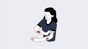 Помощь в избавлении от псориаза, аллергии (1)