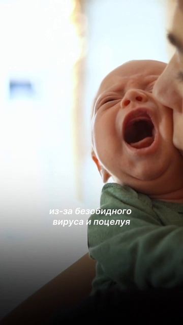 Один поцелуй — и малыш в реанимации. Герпес на губах — смертельно опасен смотреть онлайн