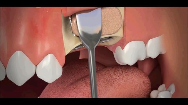 CENTAUR ВИДЕООБЗОР - XPlain