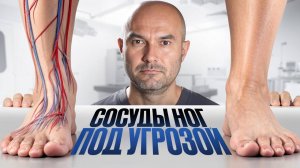 Забитые сосуды ног — как распознать без врача за 5 минут