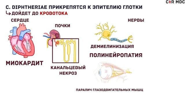 Дифтерия, причины, симптомы, диагностика, лечение смотреть онлайн