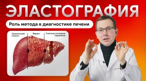 Эластография печени. Роль метода в диагностике заболеваний печени