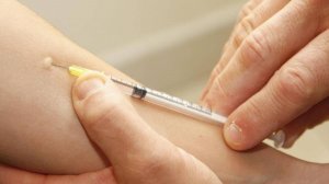 Реакция Манту, проба Пирке