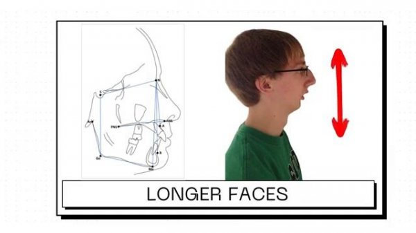 The Science of Mewing