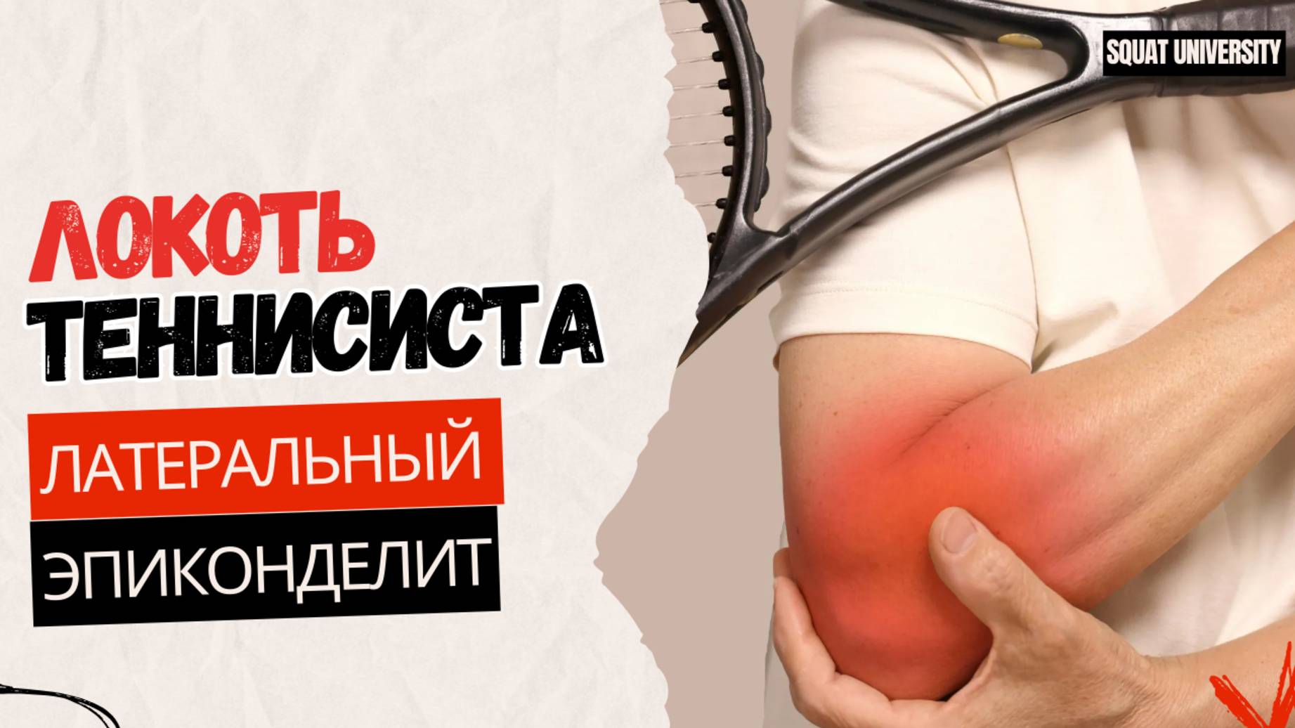 Как навсегда вылечить локоть теннисиста (без хирургического вмешательства!) смотреть онлайн