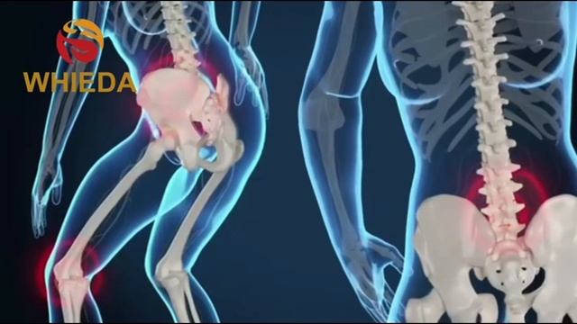 Коротко о Whieda! смотреть онлайн