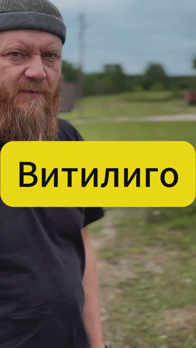 Витилиго смотреть онлайн