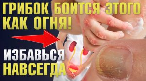 ЭТИ продукты убивают грибок! Что есть, чтобы избавиться от кандиды / Антигрибковая диета