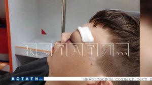 Ученика в школе избили так, что он оказался в больнице с множественными переломами костей лица