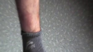 Описторхоз