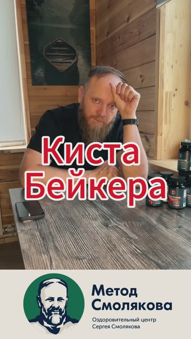 Киста Бейкера смотреть онлайн