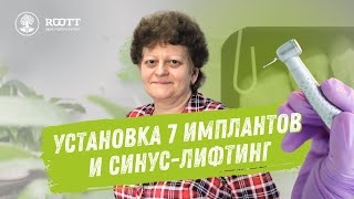Отзыв по установке имплантов в клинике имплантации зубов ROOTT в Москве смотреть онлайн