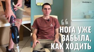 Потерял ногу во время обстрела