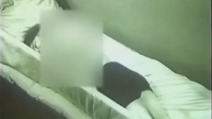 Опистотонус при столбняке