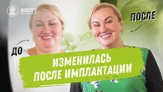Что такое ПТЕРИГОИДЫ? Необычный метод имплантации - реальный отзыв пациентки Ирины смотреть онлайн